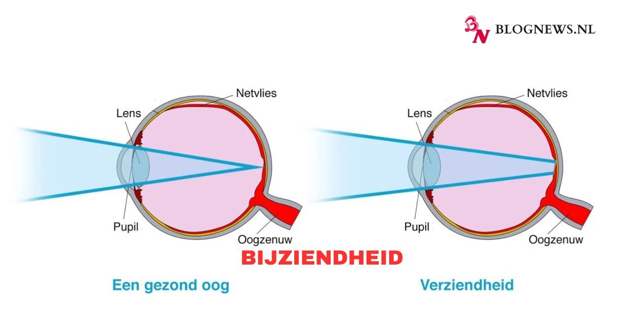 bijziendheid