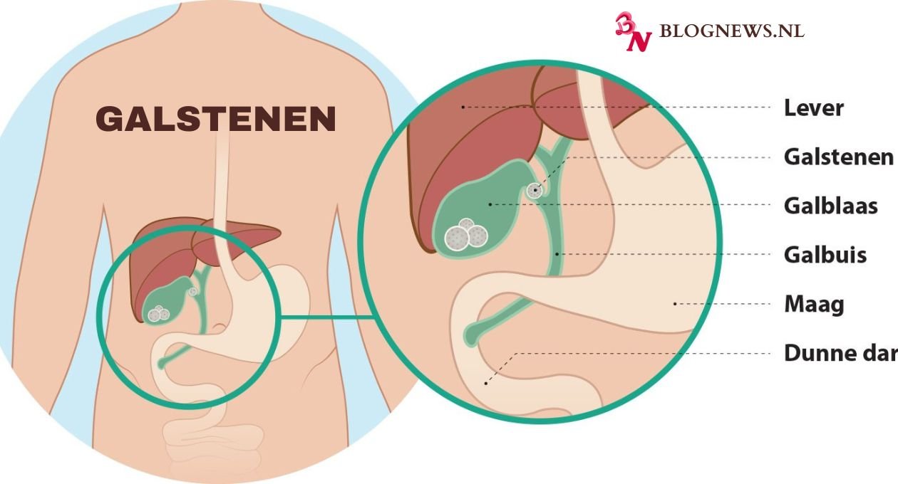 Galstenen